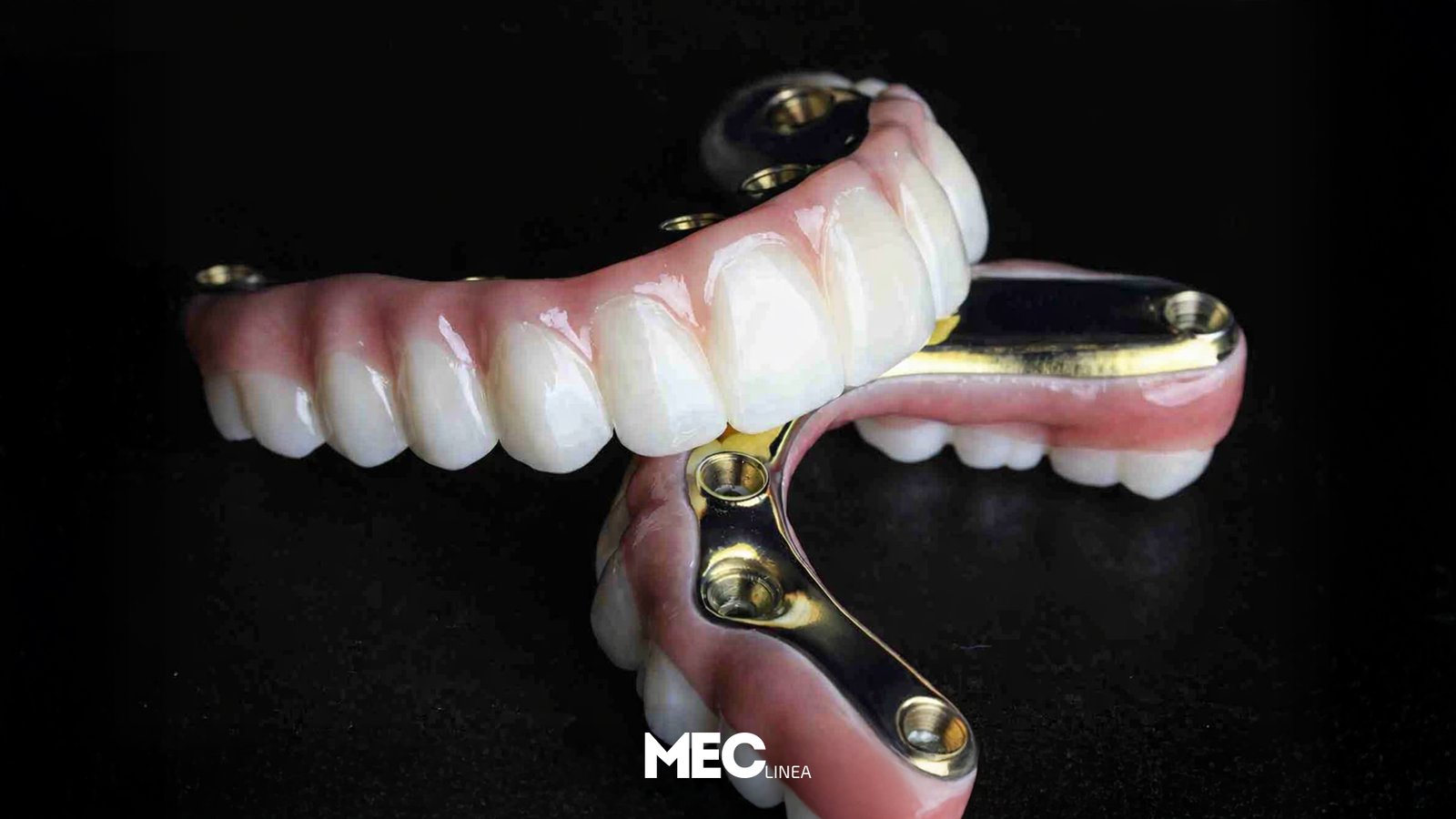 Titanyum Destekli Protez