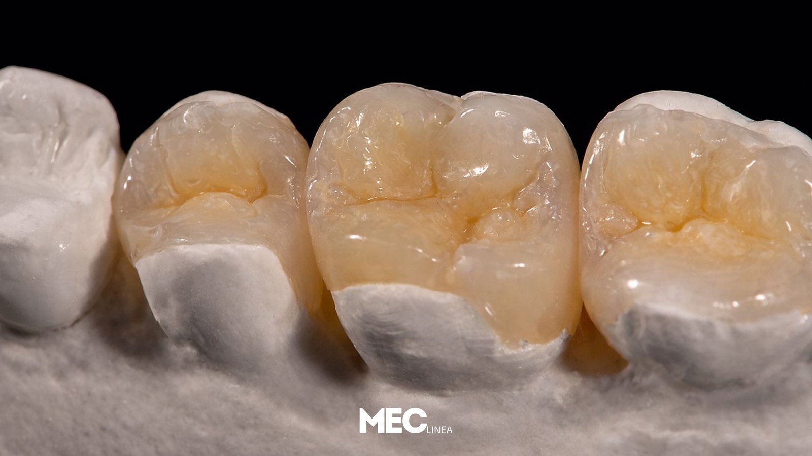 CAD - Inley & Onlay & Overlay & (Katman Blok Zirkon)